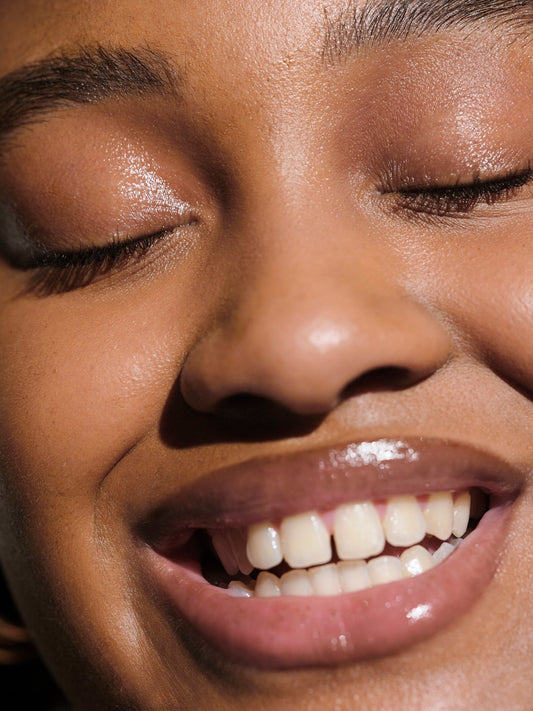 rosto de uma mulher negra sorrindo em close, com pontos iluminados na pele, que ilustram a matéria que responde a pergunta se pele oleosa sempre vai ter acne